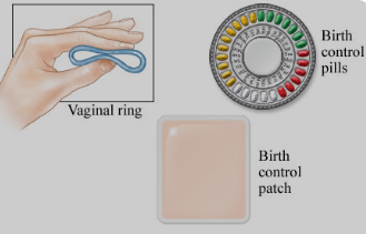 Birth Control Method